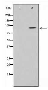 NR3C1/Glucocorticoid Receptor Antibody - Western blot of GR expression in PMA treated HeLa whole cell lysates,The lane on the left is treated with the antigen-specific peptide.