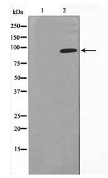 NR3C1/Glucocorticoid Receptor Antibody - Western blot of GR expression in EGF treated Jurkat whole cell lysates,The lane on the left is treated with the antigen-specific peptide.