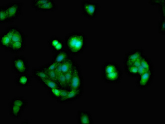 NR3C1/Glucocorticoid Receptor Antibody - Immunofluorescent analysis of HepG2 cells at a dilution of 1:100 and Alexa Fluor 488-congugated AffiniPure Goat Anti-Rabbit IgG(H+L)