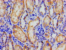 NR3C1/Glucocorticoid Receptor Antibody - Immunohistochemistry image of paraffin-embedded human kidney tissue at a dilution of 1:100