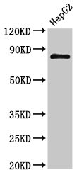 NR3C1/Glucocorticoid Receptor Antibody - Positive Western Blot detected in HepG2 whole cell lysate. All lanes: NR3C1 antibody at 3 µg/ml Secondary Goat polyclonal to rabbit IgG at 1/50000 dilution. Predicted band size: 86, 82, 65, 61 KDa. Observed band size: 86 KDa