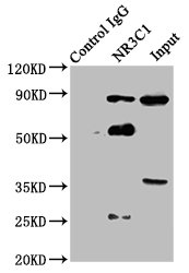 NR3C1/Glucocorticoid Receptor Antibody - Immunoprecipitating NR3C1 in Hela whole cell lysate Lane 1: Rabbit control IgG instead of NR3C1 Antibody in Hela whole cell lysate.For western blotting, a HRP-conjugated Protein G antibody was used as the secondary antibody (1/5000) Lane 2: NR3C1 Antibody (8µg) + Hela whole cell lysate (500µg) Lane 3: Hela whole cell lysate (20µg)