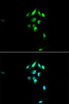 NR3C1/Glucocorticoid Receptor Antibody - Immunofluorescence analysis of U2OS cells using NR3C1 antibody at dilution of 1:100. Blue: DAPI for nuclear staining.