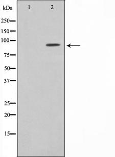 NR3C1/Glucocorticoid Receptor Antibody - Western blot analysis of GR expression in PMA treated HeLa whole cells lysates. The lane on the left is treated with the antigen-specific peptide.