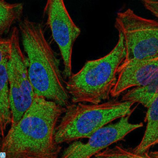 NR3C1/Glucocorticoid Receptor Antibody - Immunofluorescence (IF) analysis of PC-2 cells using GR Monoclonal Antibody (green). Blue: DRAQ5 fluorescent DNA dye. Red: Actin filaments have been labeled with Alexa Fluor-555 phalloidin.