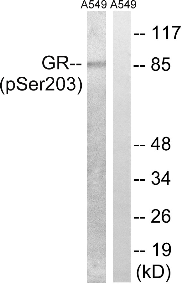 NR3C1/Glucocorticoid Receptor Antibody - Western blot of extracts from A549 cells, treated with dexamethasone (10 nM, 1 hour), using GR (Phospho-Ser203) antibody.