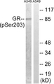 NR3C1/Glucocorticoid Receptor Antibody - Western blot of extracts from A549 cells, treated with dexamethasone (10 nM, 1 hour), using GR (Phospho-Ser203) antibody.