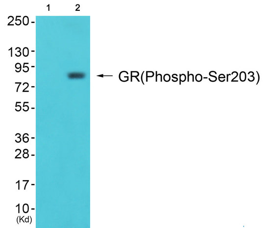 NR3C1/Glucocorticoid Receptor Antibody - Western blot of extracts from HeLa cells (Lane 2) and Hepg2 cells (Lane 3), using GR (Phospho-Ser203) Antibody. The lane on the left is treated with synthesized peptide.