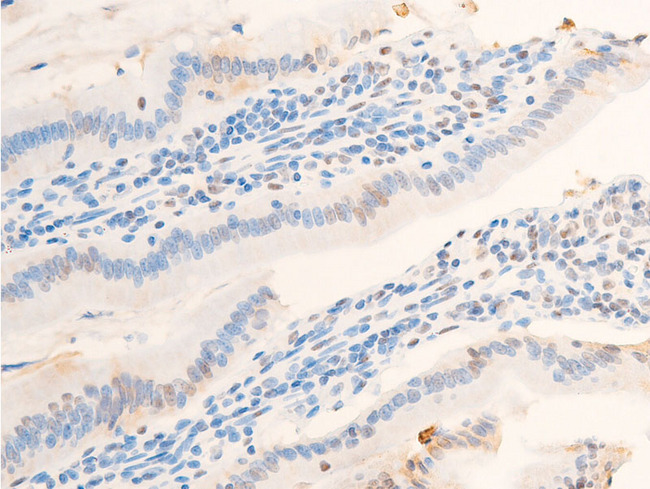 NR3C1/Glucocorticoid Receptor Antibody - 1:100 staining rat Intestinal tissue by IHC-P. The tissue was formaldehyde fixed and a heat mediated antigen retrieval step in citrate buffer was performed. The tissue was then blocked and incubated with the antibody for 1.5 hours at 22°C. An HRP conjugated goat anti-rabbit antibody was used as the secondary.