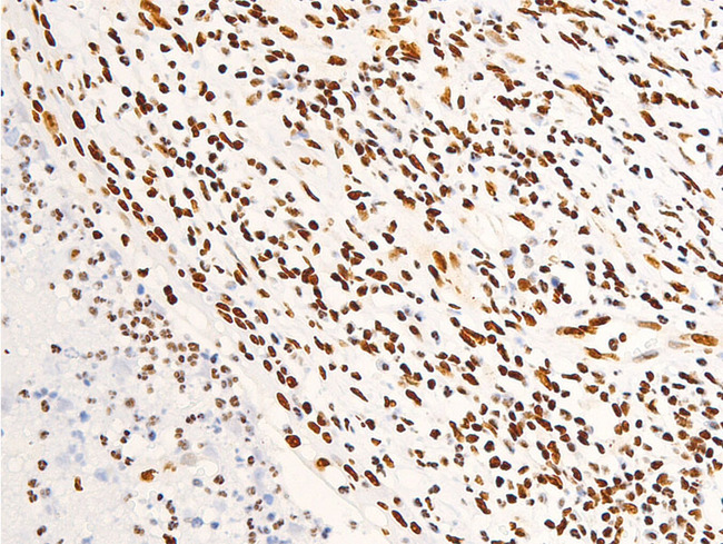 NR3C1/Glucocorticoid Receptor Antibody - 1:100 staining human TB tissue by IHC-P. The tissue was formaldehyde fixed and a heat mediated antigen retrieval step in citrate buffer was performed. The tissue was then blocked and incubated with the antibody for 1.5 hours at 22°C. An HRP conjugated goat anti-rabbit antibody was used as the secondary.