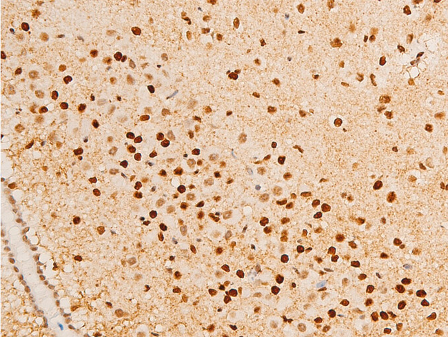 NR3C1/Glucocorticoid Receptor Antibody - 1:100 staining mouse brain tissue by IHC-P. The tissue was formaldehyde fixed and a heat mediated antigen retrieval step in citrate buffer was performed. The tissue was then blocked and incubated with the antibody for 1.5 hours at 22°C. An HRP conjugated goat anti-rabbit antibody was used as the secondary.