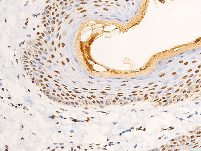 NR3C1/Glucocorticoid Receptor Antibody - 1:100 staining human skin tissue by IHC-P. The tissue was formaldehyde fixed and a heat mediated antigen retrieval step in citrate buffer was performed. The tissue was then blocked and incubated with the antibody for 1.5 hours at 22°C. An HRP conjugated goat anti-rabbit antibody was used as the secondary.