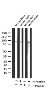 NR3C1/Glucocorticoid Receptor Antibody - Western blot analysis of Phospho-GR (Ser203) expression in various lysates