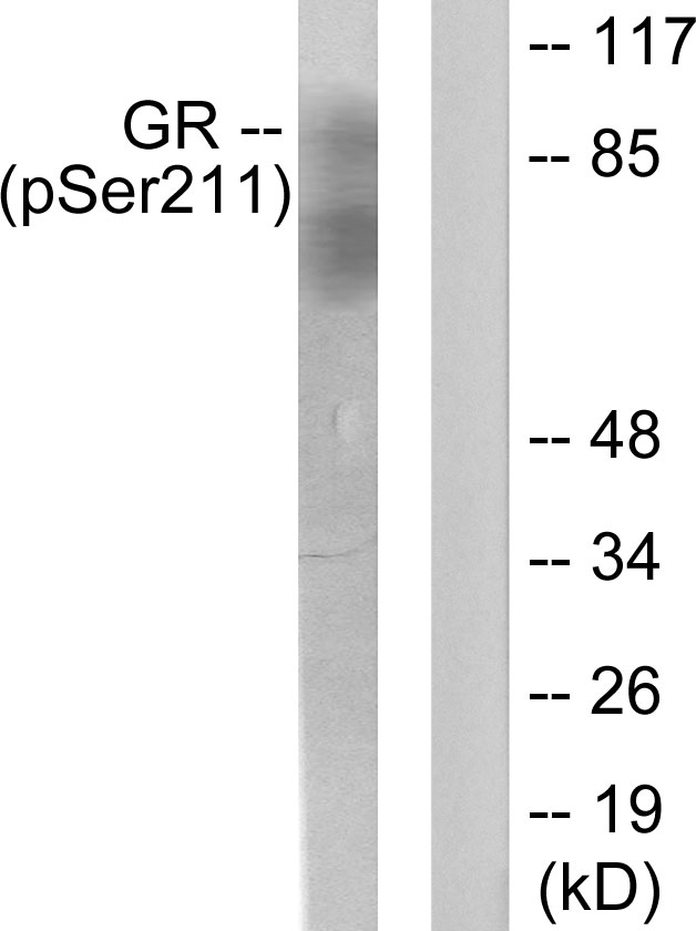 NR3C1/Glucocorticoid Receptor Antibody - Western blot analysis of lysates from HeLa cells treated with Heat shock, using GR (Phospho-Ser211) Antibody. The lane on the right is blocked with the phospho peptide.