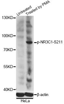 NR3C1/Glucocorticoid Receptor Antibody - Western blot analysis of extracts of HeLa cells, using Phospho-NR3C1-S211 antibody at 1:2000 dilution. HeLa cells were treated by PMA/TPA (200nM) for 15 minutes after serum-starvation overnight. The secondary antibody used was an HRP Goat Anti-Rabbit IgG (H+L) at 1:10000 dilution. Lysates were loaded 25ug per lane and 3% nonfat dry milk in TBST was used for blocking. Blocking buffer: 3% BSA.An ECL Kit was used for detection and the exposure time was 10s.
