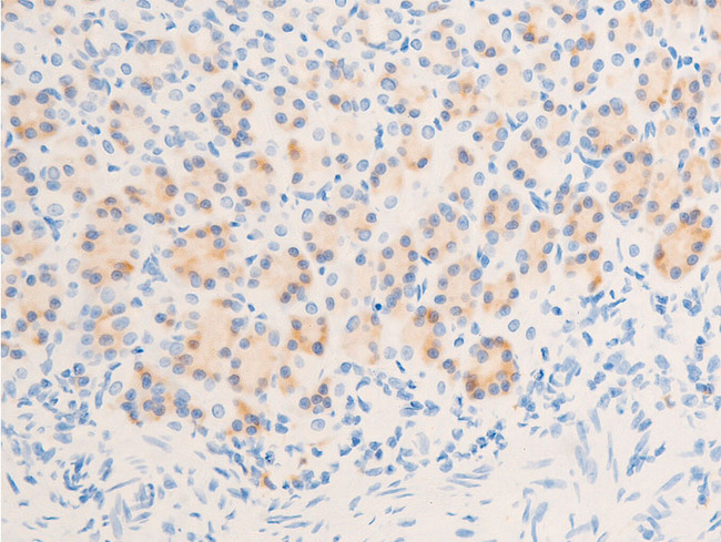 NR3C1/Glucocorticoid Receptor Antibody - 1:100 staining rat kidney tissue by IHC-P. The tissue was formaldehyde fixed and a heat mediated antigen retrieval step in citrate buffer was performed. The tissue was then blocked and incubated with the antibody for 1.5 hours at 22°C. An HRP conjugated goat anti-rabbit antibody was used as the secondary.