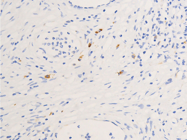NR3C1/Glucocorticoid Receptor Antibody - 1:100 staining human duodenum tissue by IHC-P. The tissue was formaldehyde fixed and a heat mediated antigen retrieval step in citrate buffer was performed. The tissue was then blocked and incubated with the antibody for 1.5 hours at 22°C. An HRP conjugated goat anti-rabbit antibody was used as the secondary.
