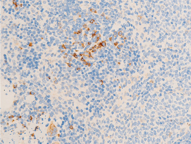 NR3C1/Glucocorticoid Receptor Antibody - 1:100 staining rat spleen tissue by IHC-P. The tissue was formaldehyde fixed and a heat mediated antigen retrieval step in citrate buffer was performed. The tissue was then blocked and incubated with the antibody for 1.5 hours at 22°C. An HRP conjugated goat anti-rabbit antibody was used as the secondary.