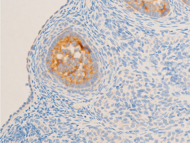 NR3C1/Glucocorticoid Receptor Antibody - 1:100 staining rat ovarian tissue by IHC-P. The tissue was formaldehyde fixed and a heat mediated antigen retrieval step in citrate buffer was performed. The tissue was then blocked and incubated with the antibody for 1.5 hours at 22°C. An HRP conjugated goat anti-rabbit antibody was used as the secondary.