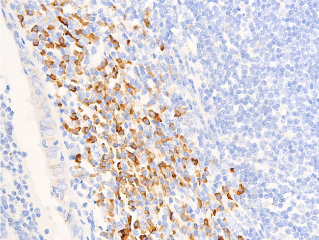 NR3C1/Glucocorticoid Receptor Antibody - 1:100 staining human appendix tissue by IHC-P. The tissue was formaldehyde fixed and a heat mediated antigen retrieval step in citrate buffer was performed. The tissue was then blocked and incubated with the antibody for 1.5 hours at 22°C. An HRP conjugated goat anti-rabbit antibody was used as the secondary.