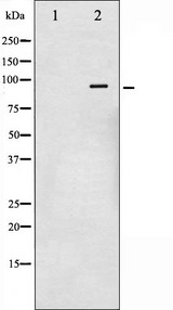 NR3C1/Glucocorticoid Receptor Antibody - Western blot analysis of GR phosphorylation expression in Heatshock treated HeLa whole cells lysates. The lane on the left is treated with the antigen-specific peptide.