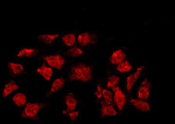 NR3C1/Glucocorticoid Receptor Antibody - Staining HeLa cells by IF/ICC. The samples were fixed with PFA and permeabilized in 0.1% Triton X-100, then blocked in 10% serum for 45 min at 25°C. The primary antibody was diluted at 1:200 and incubated with the sample for 1 hour at 37°C. An Alexa Fluor 594 conjugated goat anti-rabbit IgG (H+L) Ab, diluted at 1/600, was used as the secondary antibody.