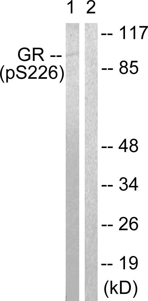 NR3C1/Glucocorticoid Receptor Antibody - Western blot analysis of lysates from Jurkat cells treated with EGF 200ng/ml 15', using GR (Phospho-Ser226) Antibody. The lane on the right is blocked with the phospho peptide.