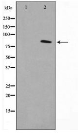 NR3C1/Glucocorticoid Receptor Antibody - Western blot of GR phosphorylation expression in EGF treated Jurkat whole cell lysates,The lane on the left is treated with the antigen-specific peptide.