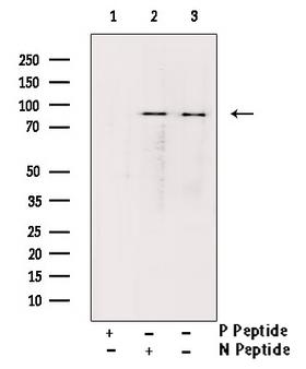 NR3C1/Glucocorticoid Receptor Antibody - Western blot analysis of GR phosphorylation expression in EGF treated rat brain tissue lysates. The lane on the right is treated with the antigen-specific peptide.