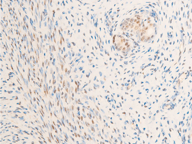 NR3C1/Glucocorticoid Receptor Antibody - 1:100 staining rat uterine tissue by IHC-P. The tissue was formaldehyde fixed and a heat mediated antigen retrieval step in citrate buffer was performed. The tissue was then blocked and incubated with the antibody for 1.5 hours at 22°C. An HRP conjugated goat anti-rabbit antibody was used as the secondary.