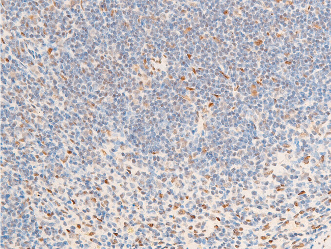 NR3C1/Glucocorticoid Receptor Antibody - 1:100 staining mouse spleen tissue by IHC-P. The tissue was formaldehyde fixed and a heat mediated antigen retrieval step in citrate buffer was performed. The tissue was then blocked and incubated with the antibody for 1.5 hours at 22°C. An HRP conjugated goat anti-rabbit antibody was used as the secondary.