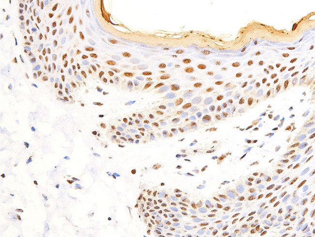 NR3C1/Glucocorticoid Receptor Antibody - 1:100 staining human skin tissue by IHC-P. The tissue was formaldehyde fixed and a heat mediated antigen retrieval step in citrate buffer was performed. The tissue was then blocked and incubated with the antibody for 1.5 hours at 22°C. An HRP conjugated goat anti-rabbit antibody was used as the secondary.