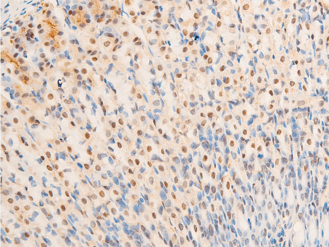 NR3C1/Glucocorticoid Receptor Antibody - 1:100 staining mouse gastric tissue by IHC-P. The tissue was formaldehyde fixed and a heat mediated antigen retrieval step in citrate buffer was performed. The tissue was then blocked and incubated with the antibody for 1.5 hours at 22°C. An HRP conjugated goat anti-rabbit antibody was used as the secondary.