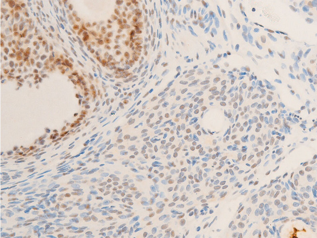 NR3C1/Glucocorticoid Receptor Antibody - 1:100 staining rat ovarian tissue by IHC-P. The tissue was formaldehyde fixed and a heat mediated antigen retrieval step in citrate buffer was performed. The tissue was then blocked and incubated with the antibody for 1.5 hours at 22°C. An HRP conjugated goat anti-rabbit antibody was used as the secondary.