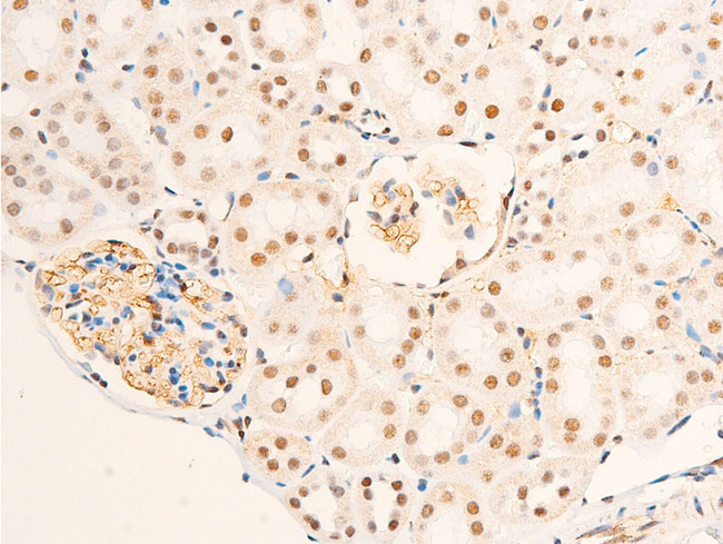 NR3C1/Glucocorticoid Receptor Antibody - 1:100 staining mouse kidney tissue by IHC-P. The tissue was formaldehyde fixed and a heat mediated antigen retrieval step in citrate buffer was performed. The tissue was then blocked and incubated with the antibody for 1.5 hours at 22°C. An HRP conjugated goat anti-rabbit antibody was used as the secondary.