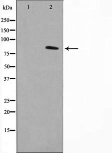 NR3C1/Glucocorticoid Receptor Antibody - Western blot analysis of GR phosphorylation expression in EGF treated Jurkat whole cells lysates. The lane on the left is treated with the antigen-specific peptide.