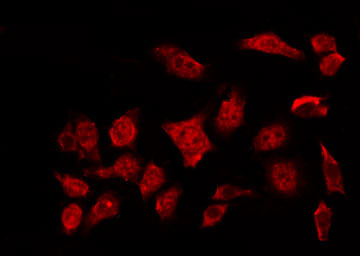 NR3C1/Glucocorticoid Receptor Antibody - Staining HeLa cells by IF/ICC. The samples were fixed with PFA and permeabilized in 0.1% Triton X-100, then blocked in 10% serum for 45 min at 25°C. The primary antibody was diluted at 1:200 and incubated with the sample for 1 hour at 37°C. An Alexa Fluor 594 conjugated goat anti-rabbit IgG (H+L) Ab, diluted at 1/600, was used as the secondary antibody.