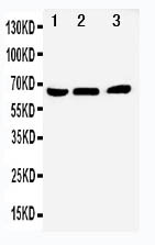 NR4A1 / NUR77 Antibody - WB of NR4A1 / NUR77 antibody. All lanes: Anti-NR4A1 at 0.5ug/ml. Lane 1: A431 Whole Cell Lysate at 40ug. Lane 2: HELA Whole Cell Lysate at 40ug. Lane 3: JURKAT Whole Cell Lysate at 40ug. Predicted bind size: 64KD. Observed bind size: 64KD.