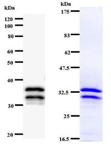 NR4A1 / NUR77 Antibody - Western blot of immunized recombinant protein using NR4A1 antibody. Left: NR4A1staining. Right: Coomassie Blue staining of immunized recombinant protein.