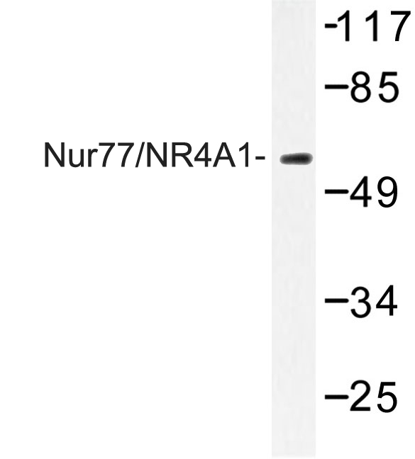 NR4A1 / NUR77 Antibody - Western blot of Nur77/NR4A1 (G347) pAb in extracts from Jurkat cells.