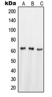 NR4A1 / NUR77 Antibody - Western blot analysis of NUR77 expression in HeLa (A); HepG2 (B); SHSY5Y (C) whole cell lysates.