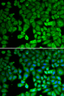 NR4A1 / NUR77 Antibody - Immunofluorescence analysis of U2OS cells using NR4A1 antibody. Blue: DAPI for nuclear staining.