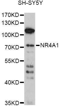 NR4A1 / NUR77 Antibody - Western blot analysis of extracts of SH-SY5Y cells, using NR4A1 antibody at 1:1000 dilution. The secondary antibody used was an HRP Goat Anti-Rabbit IgG (H+L) at 1:10000 dilution. Lysates were loaded 25ug per lane and 3% nonfat dry milk in TBST was used for blocking. An ECL Kit was used for detection and the exposure time was 30s.