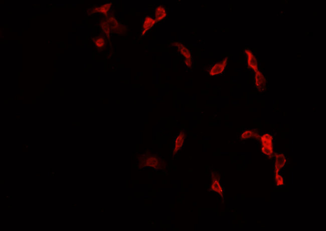 NR4A1 / NUR77 Antibody - Staining HepG2 cells by IF/ICC. The samples were fixed with PFA and permeabilized in 0.1% Triton X-100, then blocked in 10% serum for 45 min at 25°C. The primary antibody was diluted at 1:200 and incubated with the sample for 1 hour at 37°C. An Alexa Fluor 594 conjugated goat anti-rabbit IgG (H+L) antibody, diluted at 1/600, was used as secondary antibody.