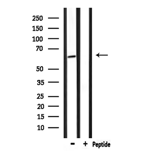 NR4A1 / NUR77 Antibody - Western blot analysis of extracts of mouse brain tissue using NR4A1 antibody.