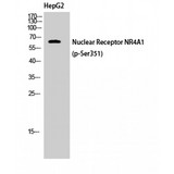NR4A1 / NUR77 Antibody - Western blot of Phospho-Nur77 (S351) antibody