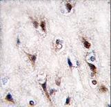 NR4A2 / NURR1 Antibody - Formalin-fixed and paraffin-embedded human brain tissue reacted with NURR1 (NR4A2) antibody , which was peroxidase-conjugated to the secondary antibody, followed by DAB staining. This data demonstrates the use of this antibody for immunohistochemistry; clinical relevance has not been evaluated.