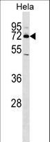 NR4A2 / NURR1 Antibody - NR4A2 Antibody western blot of HeLa cell line lysates (35 ug/lane). The NR4A2 antibody detected the NR4A2 protein (arrow).