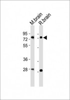 NR4A2 / NURR1 Antibody - All lanes : Anti-Nr4a2 Antibody at 1:2000 dilution Lane 1: mouse brain lysates Lane 2: rat brain lysates Lysates/proteins at 20 ug per lane. Secondary Goat Anti-Rabbit IgG, (H+L), Peroxidase conjugated at 1/10000 dilution Predicted band size : 67 kDa Blocking/Dilution buffer: 5% NFDM/TBST.