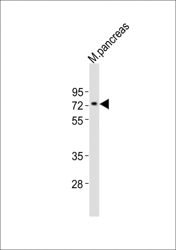 NR4A2 / NURR1 Antibody - Anti-Nr4a2 Antibody at 1:2000 dilution + mouse pancreas lysates Lysates/proteins at 20 ug per lane. Secondary Goat Anti-Rabbit IgG, (H+L), Peroxidase conjugated at 1/10000 dilution Predicted band size : 67 kDa Blocking/Dilution buffer: 5% NFDM/TBST.